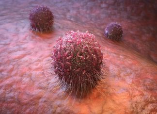 “New Findings: Cancer Cells Mislead the Brain”